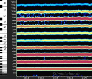 Frequenz-Bild einer Stimme